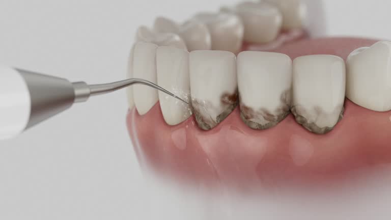 Trusted Teeth Cleaning And Checkup service in Franklin, CA - Dentist Open Now